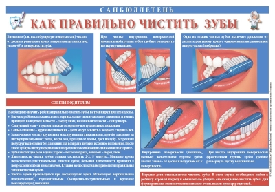 Санбюллетень Как правильно чистить зубы